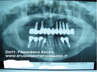 Centro Implantologia Dentale Salerno