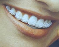 http://www.studiodentisticosacco.it/media//thumb.jpg
