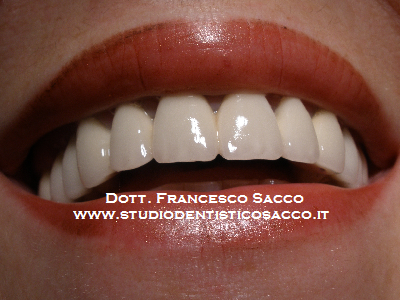 dentista potenza dr. Francesco sacco