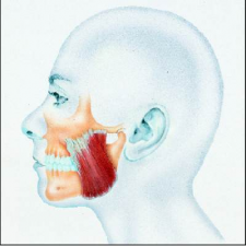 Malocclusione Centro Gnatologia Salerno