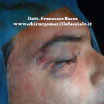 Fine intervento