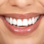 fascette-denti
