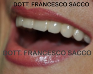 Studio Dentistico Sacco Estetica Dentale Dentista Salerno Dr. Francesco Sacco