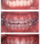 thumb_ortho