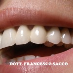 Implantologia Potenza Dr. Francesco Sacco