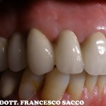 Studio dentistico Sacco Estetica Dentale