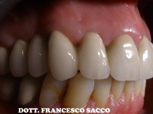Studio Dentistico Sacco Estetica Dentale implantologia avellino