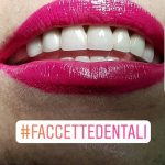 FACCETTE DENTALI SALERNO DR. SACCO