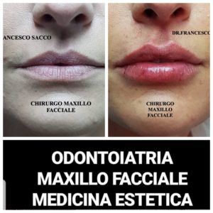 Medicina Estetica Polla