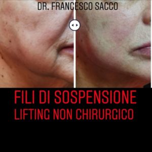 studio dentistico dr. francesco sacco Centri Dentistici Dr.Francesco Sacco Chirurgo Maxillo Facciale Estetica