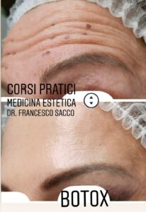 botox dr. francesco sacco